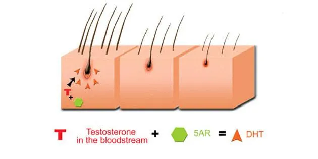 Hair Loss