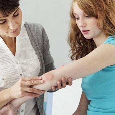 Quels sont les facteurs favorisant le psoriasis ?