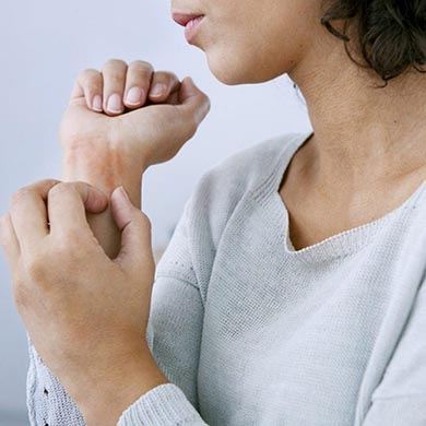 Eczéma marginé de Hébra