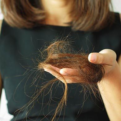 Chute de Cheveux : causes et traitements