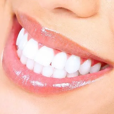 Blanchiment des dents : tout ce qu'il faut savoir pour des dents blanches