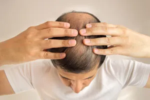 Homme avec des cheveux clairsemés