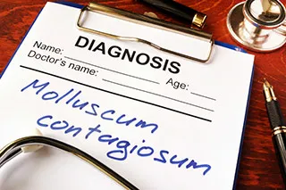 Photo d'une feuille de diagnostique du Molluscum Contagiosum | Shytobuy.fr