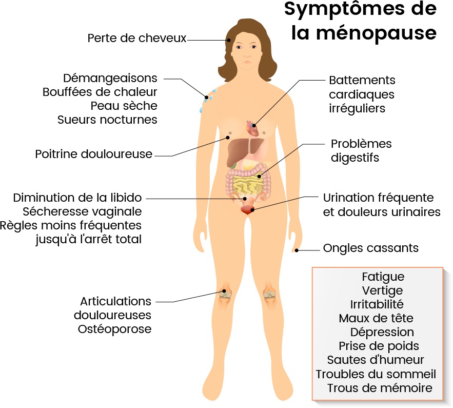 Infographie reprenant tous les symptômes de la ménopause d'une femme en les indiquant où ils se manifestent - Comment savoir si je suis ménopausée ? - ShytoBuy France